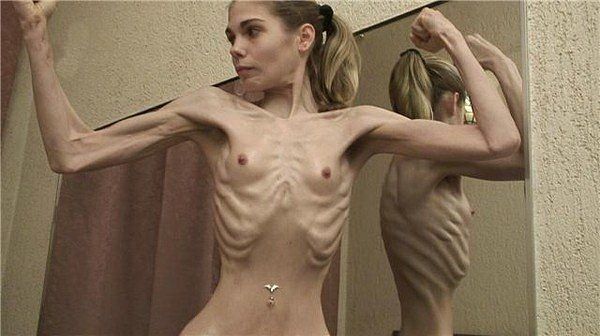 Anorexic big tits - 🧡 Skinny Girls Anorexic Girls Pics Videos Boney Bony P...